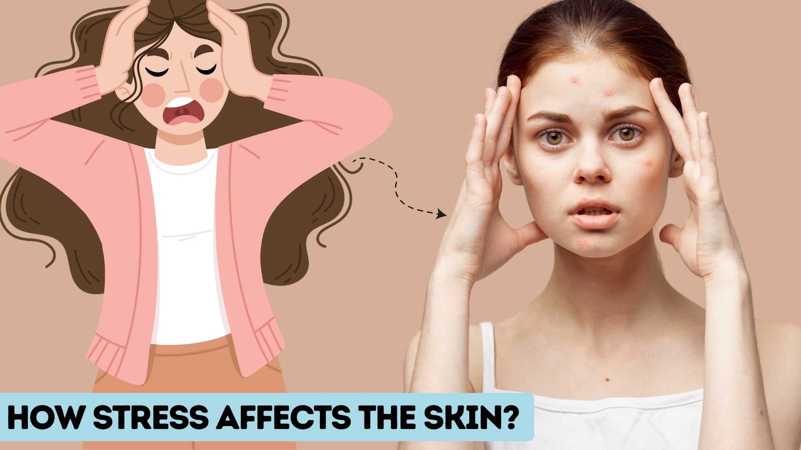 Beauty Queen Beauty Parlour How stress affects the Skin