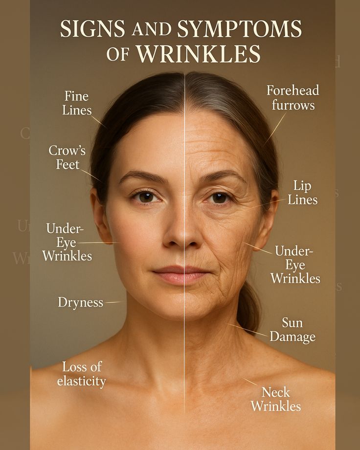 Beauty Queen Beauty Parlour Signs Symptoms Early Warnings of Wrinkles You Shouldnt Ignore